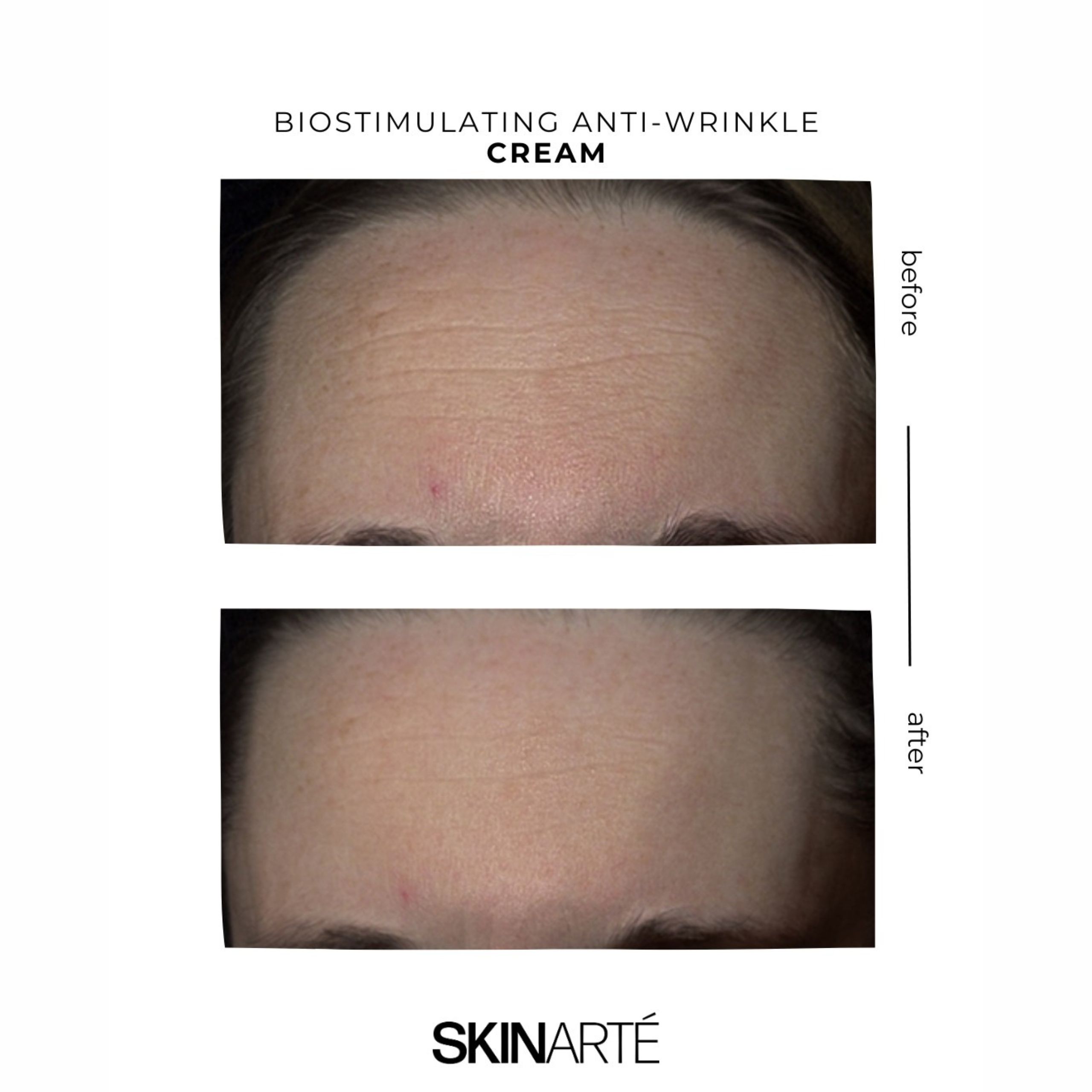 Крем для лица SkinArte биостимулирующий, против морщин, для дня и ночи — фото 4
